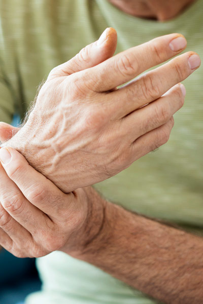 L'arthrose, la plus fréquente des maladies articulaires
